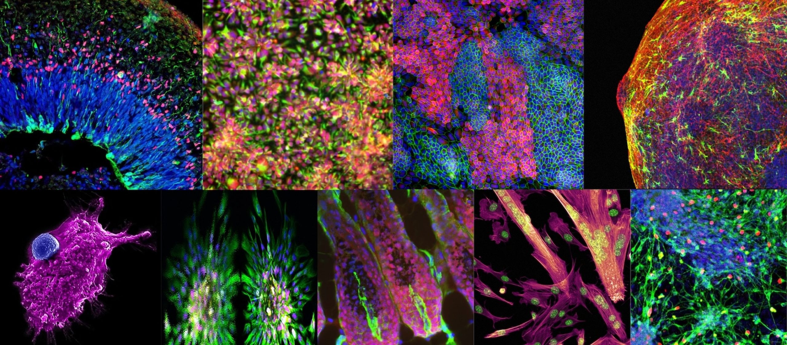 A magnified view of a collage of vibrant and colorful stem cells as seen using imaging equipment